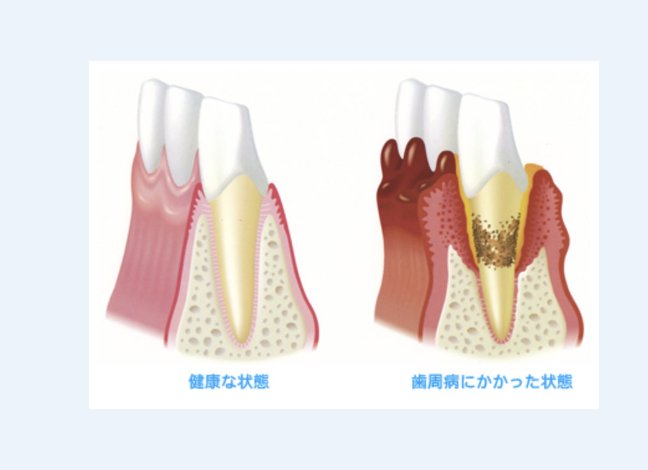 歯周病治療を通じて患者様の健康を支えています