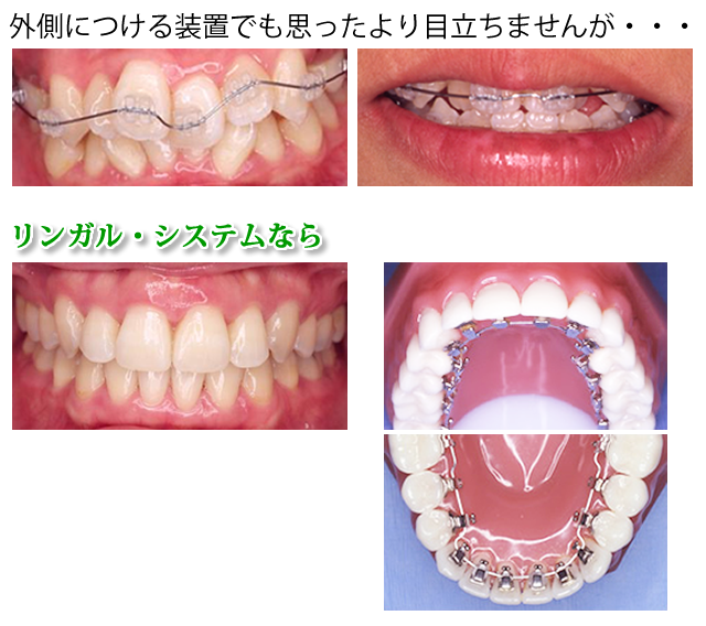 患者様一人ひとりに最適な矯正治療を提供します。