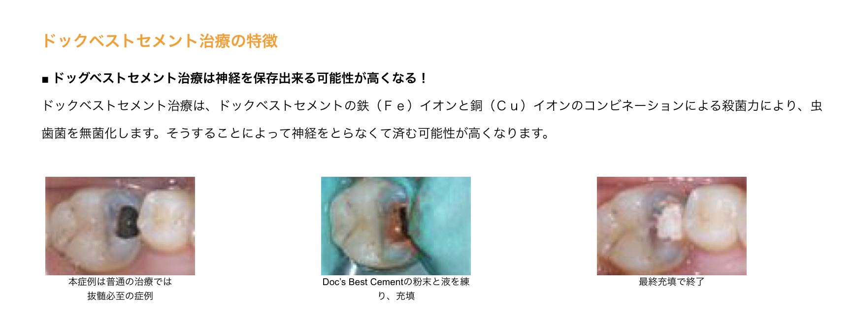 治療後も歯の健康を長く守ることを目指し、丁寧な診療を行っています