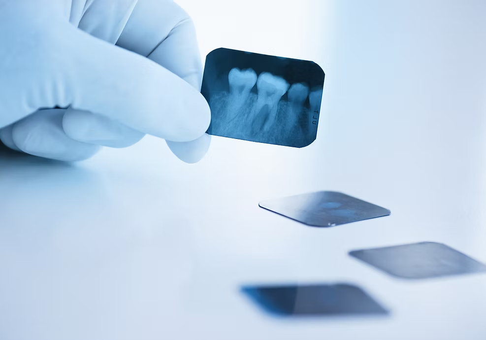 女性歯科医師によるリラックスできる環境での丁寧な一般歯科治療