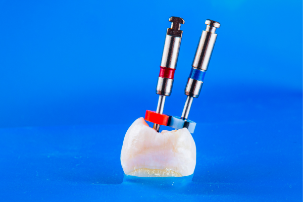 痛みを抑えた根管治療で、大切な歯を守ります