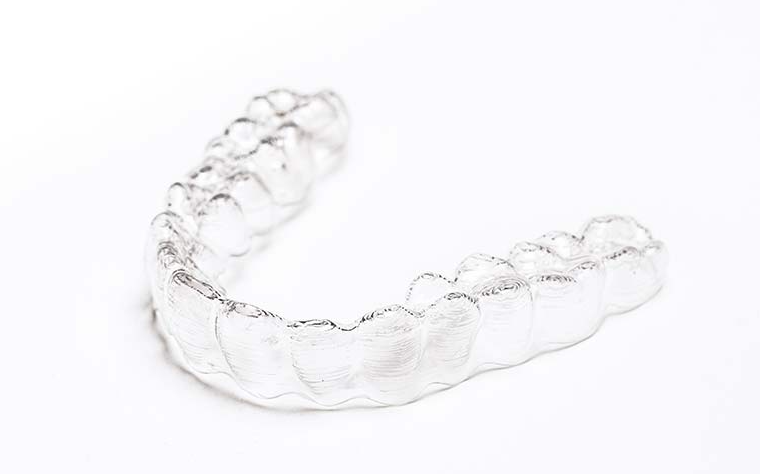 インビザライン矯正