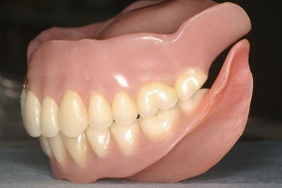 院内技工で最適な義歯作成が可能です