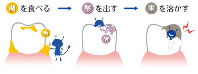 歯周病の原因菌を特定して根本的な改善を図ります