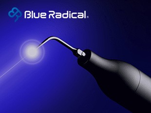 歯周病治療機器「ブルーラジカル P−01」