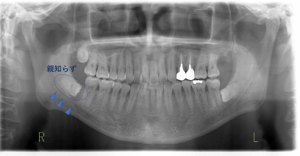 機能回復と安全性を重視した口腔外科診療を行っています。