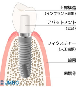 患者様の状態に応じて、最も適した方法を提案し、治療を進めています。