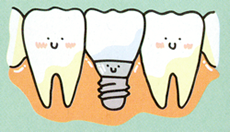 インプラント治療は、咀嚼機能を回復し、美容的にも優れた結果を提供します。