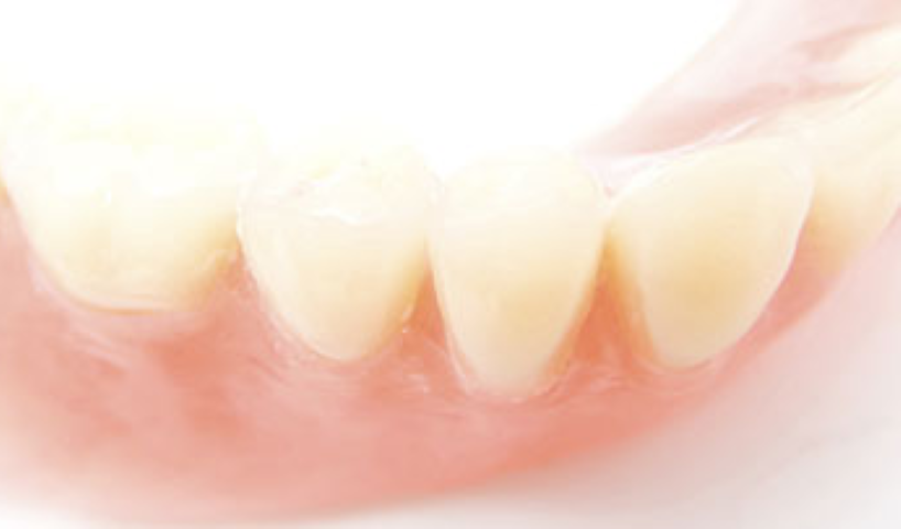 患者様目線で進めるクローバー歯科の外科治療