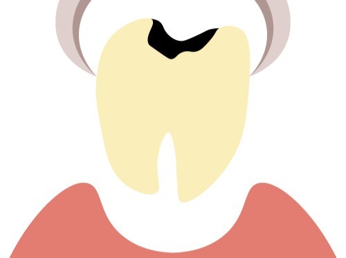 写真はイメージです