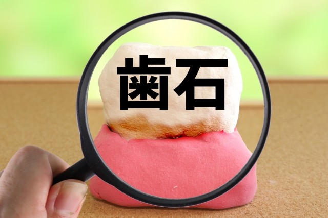 写真はイメージです