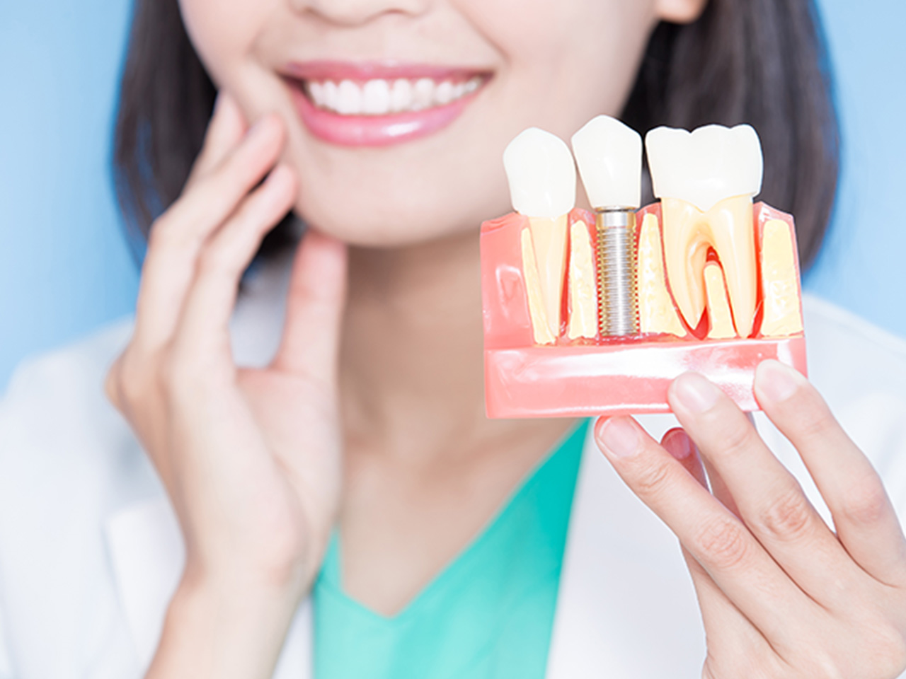 インプラント治療