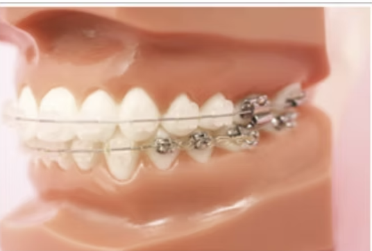 専門医による矯正治療