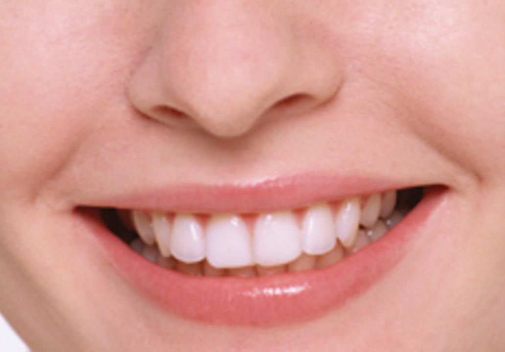 安全で効果的なホワイトニングで、自信の持てる笑顔を取り戻します