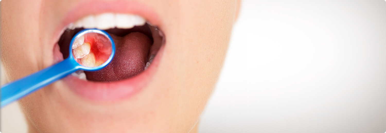 歯周病治療を通じて患者様の口腔だけでなく全身の健康維持にも貢献することを目指しています