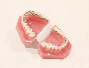 ⽬⽴ちにくい矯正装置