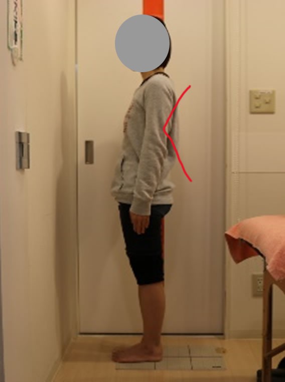 根本原因は姿勢にあります