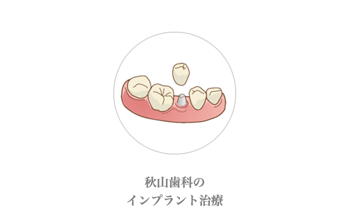 患者様の口腔内の状態を丁寧に診断し、それぞれに最適な治療プランを提案します