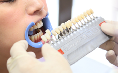 ビヨンド導入しました