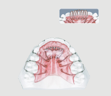 治療中の不安や疑問については、カウンセリングでしっかりとサポートさせていただきますので、お気軽にご相談ください。