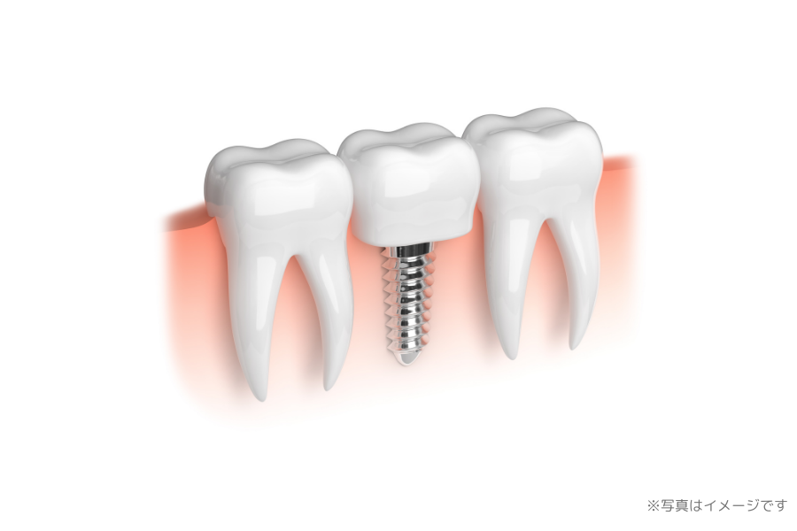 精密な診査と綿密な計画のもと、快適な噛み心地を目指した治療を行っています