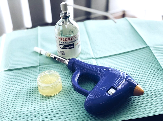 お口の変化に気づいたら、ぜひ早めのご相談をおすすめします