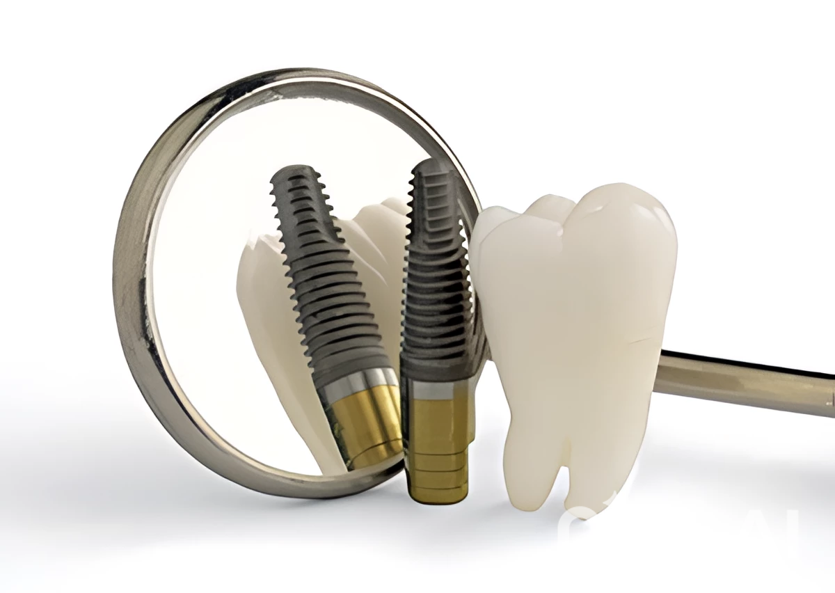 インプラント治療では、相談から手術、メンテナンスまで同じ医師が担当します。