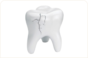 虫歯を早期発見、将来の健康を守る