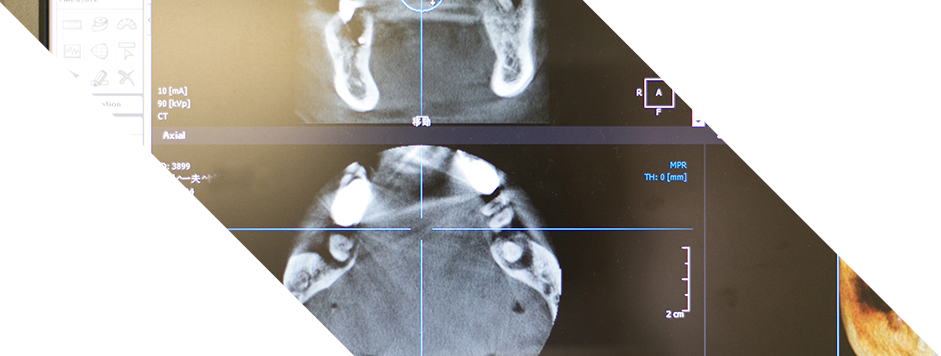 【口腔外科専門医 在籍】【藤井寺駅 徒歩1分】外科処置から矯正・予防まで幅広く対応する椿本歯科医院
