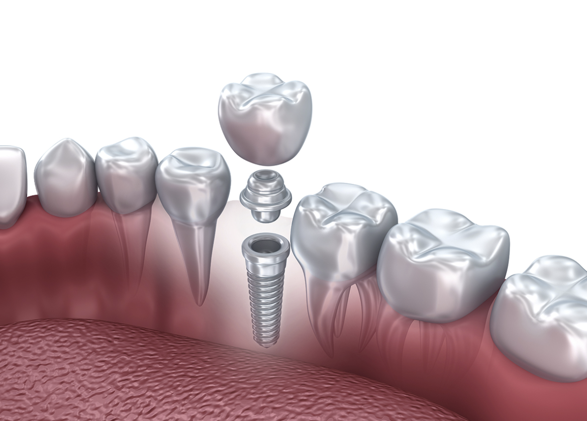患者様に安心して治療を受けていただけるよう、丁寧な説明と治療を心がけています