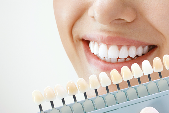 ホームホワイトニングを提供しています