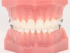 年齢に関係なく矯正治療できます