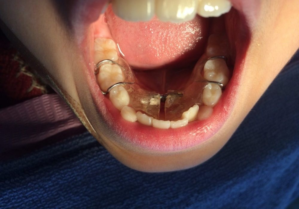 お子様が歯科医院に対して恐怖心を持たず、安心して通える環境づくりを重視しています。