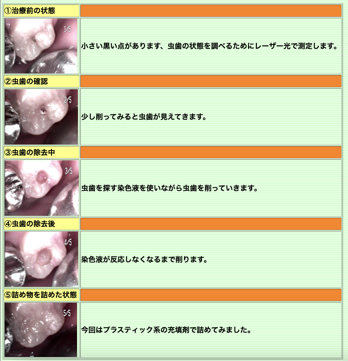 ①医院のご案内 ②虫歯の治療前、治療中、治療後の写真 ③院内風景
