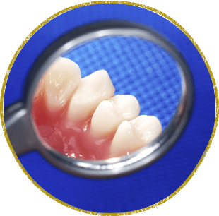 成人されている方は症状の有無に関わらず、定期的な検診をおすすめします。