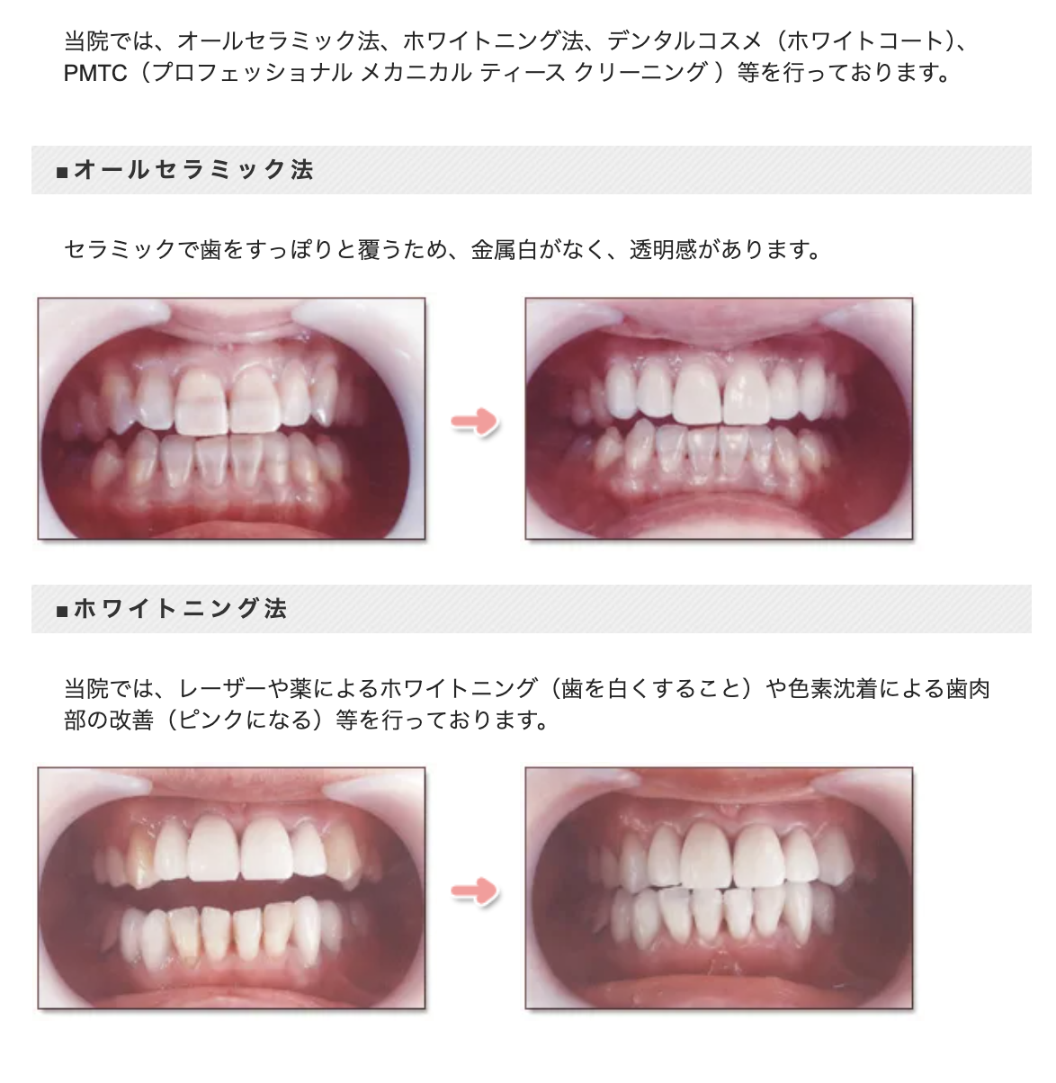 自然で美しい歯と健康的な口元を目指すお手伝いをしています