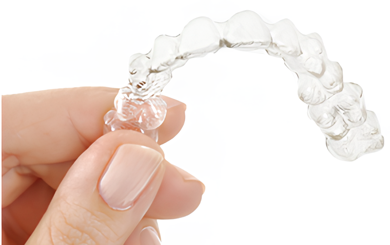 3つのパッケージから選べるマウスピース矯正で美しい歯並びを実現