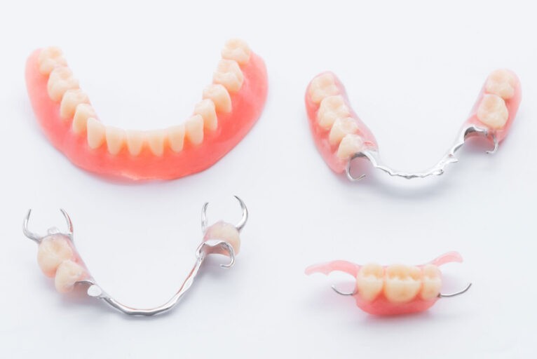 患者様の状況や希望に応じて最適な義歯を提案しています