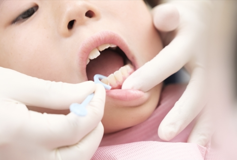 小児歯科治療の様子