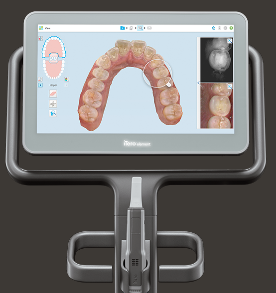 患者様の個別のニーズに応じたカスタムメイド型リンガルブラケット矯正装置を提供しています