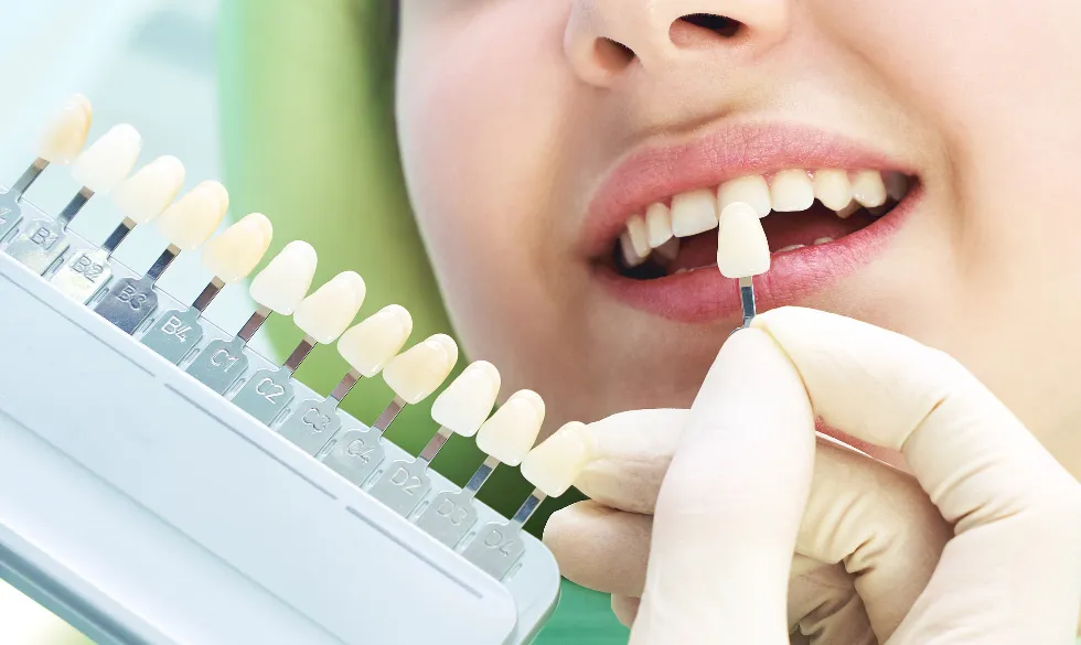 白い歯で明るい笑顔に