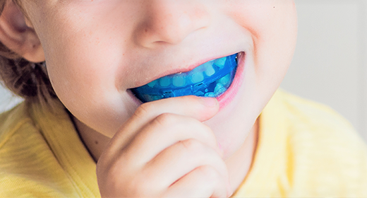 スポーツマウスガードも専門です