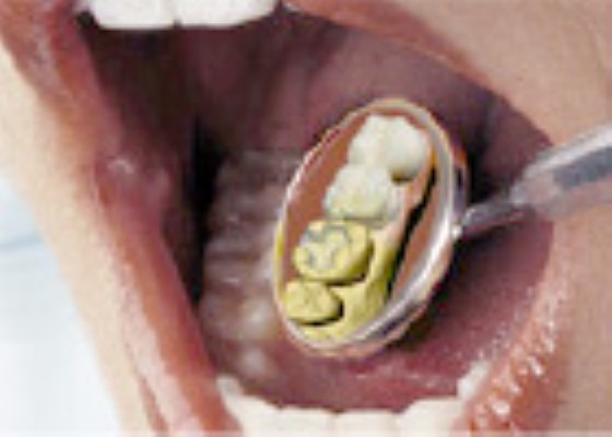 医療先進国ドイツで開発されたCAD/CAM技術「セレック（CEREC）システム」を導入しています。