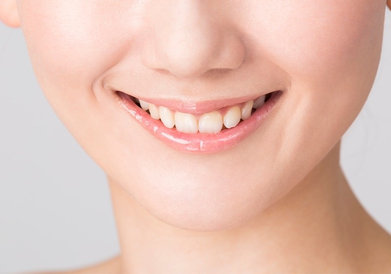 自然な口元を意識した処置を行っています