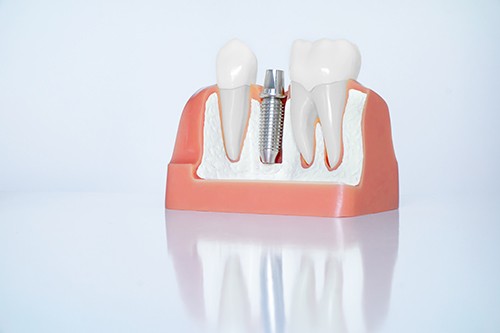 ※画像はイメージです。