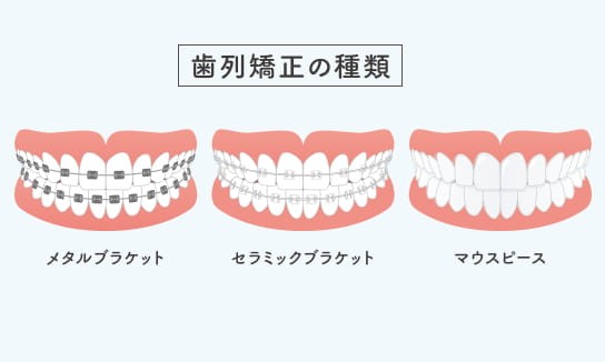 ※画像はイメージです。