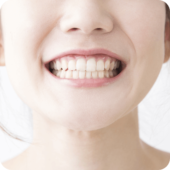 不正咬合は放置しておくと悪化していきます