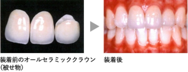 見た目の改善に加えて、噛み合わせや歯の健康を長く保つことを目的とした診療を行っています。