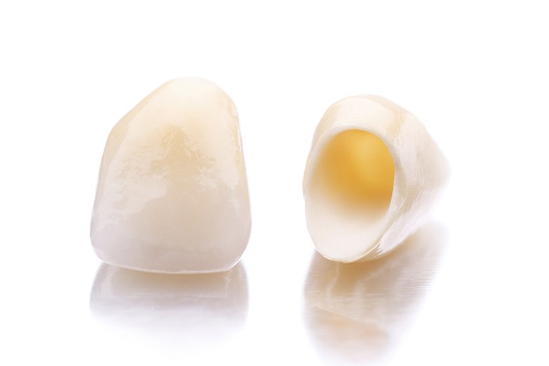 口腔全体の調和を大切にした詰め物・かぶせ物の製作を行っています