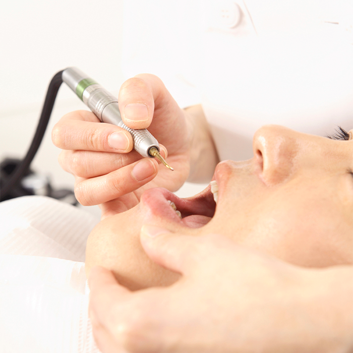 的確な口腔外科治療をおこないます